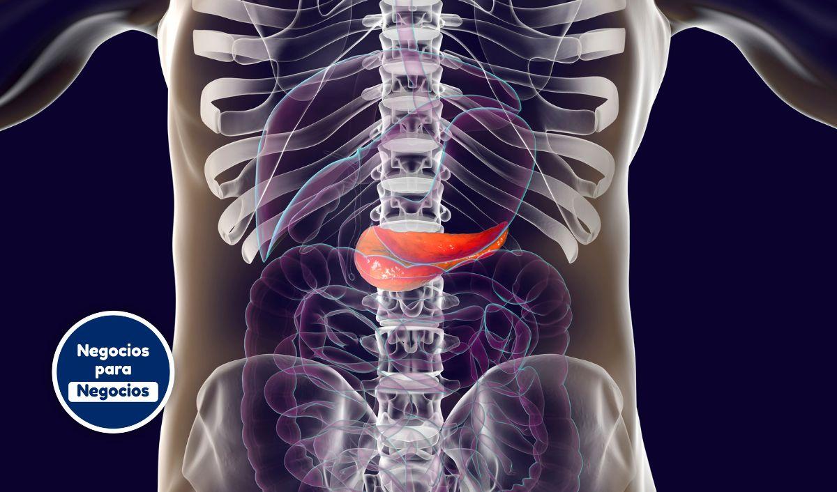 Algoritmo espa&ntilde;ol anticipa met&aacute;stasis en c&aacute;ncer de p&aacute;ncreas