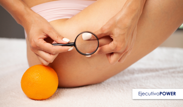 Combate la aparici&oacute;n de la celulitis: &iexcl;Dile adi&oacute;s a la piel de naranja!