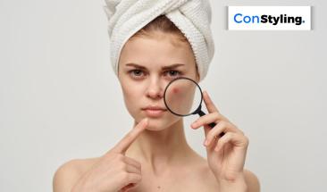 Impacto de la alimentaci&oacute;n en la piel: claves para combatir el acn&eacute;