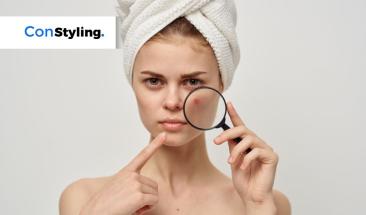 Riesgos potenciales del per&oacute;xido de benzoilo y el benceno para el acn&eacute;