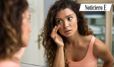 Bolsas en los ojos: &iquest;Qu&eacute; son y c&oacute;mo combatirlas?