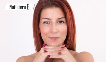 Beneficios y mitos de los suplementos de col&aacute;geno