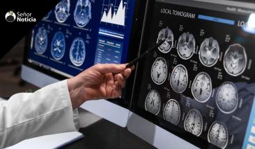 Implante cerebral permite a paciente con par&aacute;lisis comunicarse en dos idiomas