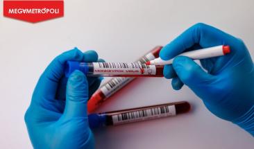 Expertos afirman que la mpox no representa una nueva pandemia como la covid-19