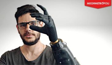 Cient&iacute;ficos desarrollan primera mano prot&eacute;sica controlada solo con el pensamiento