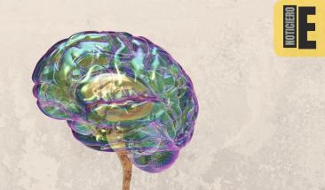 Cient&iacute;ficos crean cerebro de gel que aprende a jugar videojuegos Pong