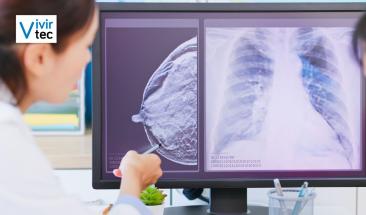 IA anticipa diagn&oacute;sticos con cinco a&ntilde;os de antelaci&oacute;n para c&aacute;ncer de mama