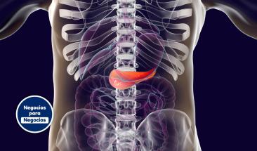 Algoritmo español anticipa metástasis en cáncer de páncreas Algoritmo español anticipa metástasis en cáncer de páncreas