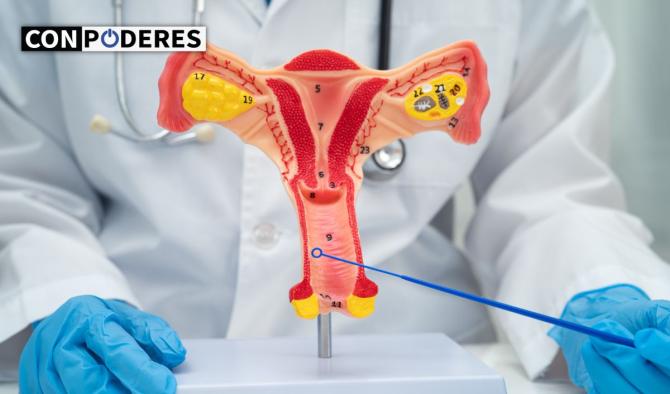 La cient&iacute;fica mexicana que est&aacute; cambiando la historia del VPH con terapia l&aacute;ser